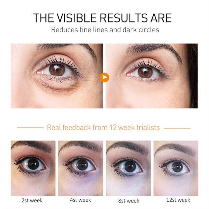 Trebendo™ Eye Repair Cream | Augencreme – Schwellungen und Augenringe
